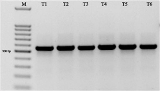 PCR products of the ITS2 for the species of 
							T. evanescens from different samples (M: Molcular marker, T1-T6: Different 
							Trichogramma samples).
						