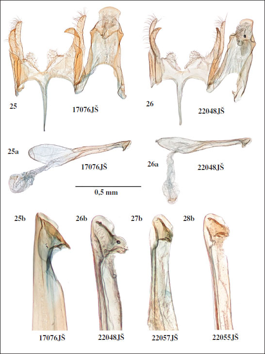 Male genitalia of 
										Klimeschiopsis varia Šumpich & Bidzilya, sp. n. 
										25. Holotype, Dzhangyskol lake. 
										26-28. Paratypes. 
										26. Krasnaya Gorka. 
										27. Chylushman valley. 
										28. Karagem. (a - phallus, b - detail of tip of phallus: 25-26. Lateral view, 27-28. Frontal view).
									
