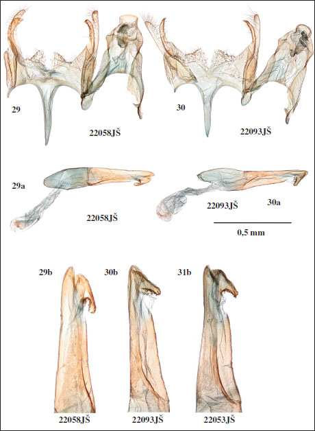 Male genitalia of 
														Klimeschiopsis confusella. Šumpich & Bidzilya, sp. n., paratypes. 
														29. Dzhazator, Tara valley. 
														30. Aktash. 
														31.Dzhangyskol lake. (a - phallus, b - detail of tip of phallus, lateral view).
													