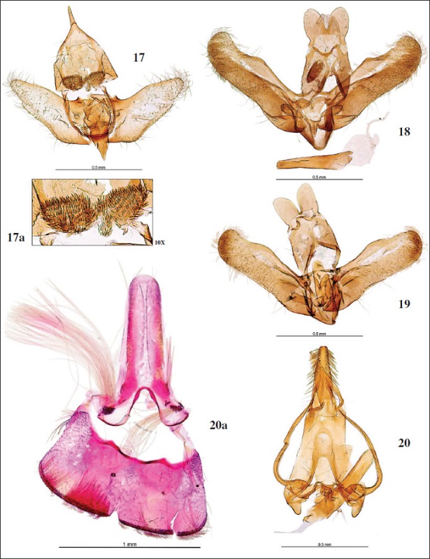 Genitalia macho: 
								17.Agnoea nonscriptellaCorley, 2014, prep. gen. 8665JG. 
								17a. Ídem, detalle del gnathos. 
								18.Elachista pollutella Duponchel 1842 [1843], prep. gen. 9405JG. 
								19.Elachista vulcana Kaila, 2011, prep. gen. 9404JG. 
								20.Neotelphusa cisti (Staiton, 1869), prep. gen. 8964JG. 
								20a. Ídem, 81 segmento.
							