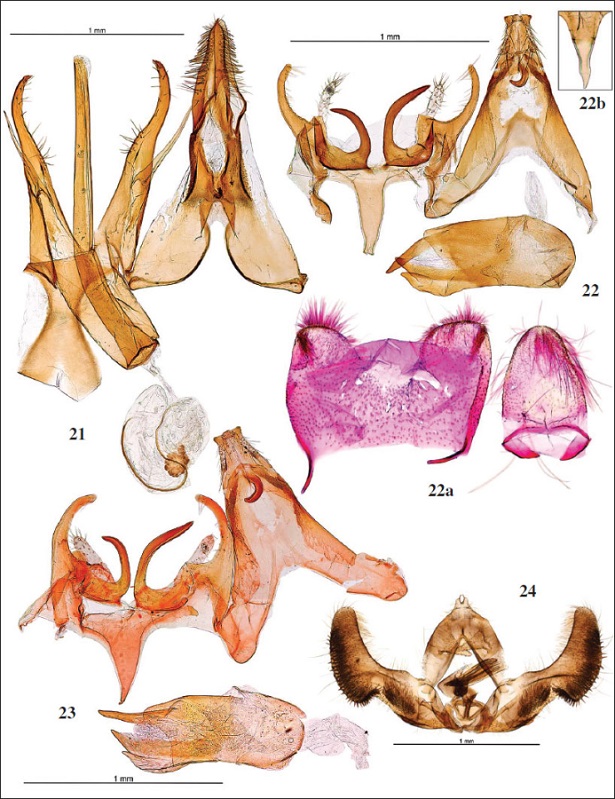 Genitalia macho: 
											21.Teleiopsis paulhebertiHuemer & Mutanen, 2012, prep. gen. 9435JG. 
											22.Filatima huemeri Gastón & Vives, sp. nov., Paratipo, prep. gen. 9200JG. 
											22a. Ídem, 81 segmento. 
											22b. Ídem, prep. gen. 9202JG, detalle del saccus. 
											23.Filatima textorella (Chrétien, 1908), France, prep. gen. GEL 32 PH (TLMF). 
											24.Epinotia cruciana (
											Linnaeus, 1761), prep. gen. 9298JG.
										