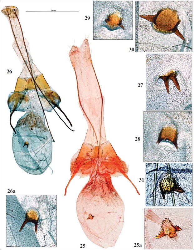 Genitalia hembra: 
												25.Filatima textorella (Chrétien, 1908), France, prep. gen. GEL 769 P.H. (TLMF). 
												25a. Ídem, detalle del signum. 
												26.Filatima huemeri Gastón & Vives, sp. n., Holotipo, prep. gen. 9201JG. 
												26a. Idem, detalle del signum. 
												27-30.Filatima huemeri Gastón & Vives, sp. nov., signum; 
												27. Paratipo, prep. gen. 9088JG. 
												28. Paratipo, prep. gen. 9203JG. 
												29. Paratipo, prep. gen. 9205JG. 
												30. Paratipo, prep. gen. 9204JG. 
												31.Filatima textorella (Chrétien, 1908), signum: Francia, prep. gen. 90 18 f. c. OLEK
											
