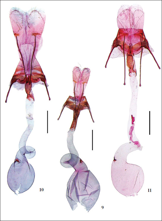 Female genitalia of 
									Athrips spp. 
									9.A. lingchuana Oh & Li, sp. nov., paratype, slide No. OHJ20754. 
									10.A. pruinosella, slide No. OHJ20751. 
									11.A. spiraeae, slide No. OHJ20730. (scales = 0.5 mm).
								