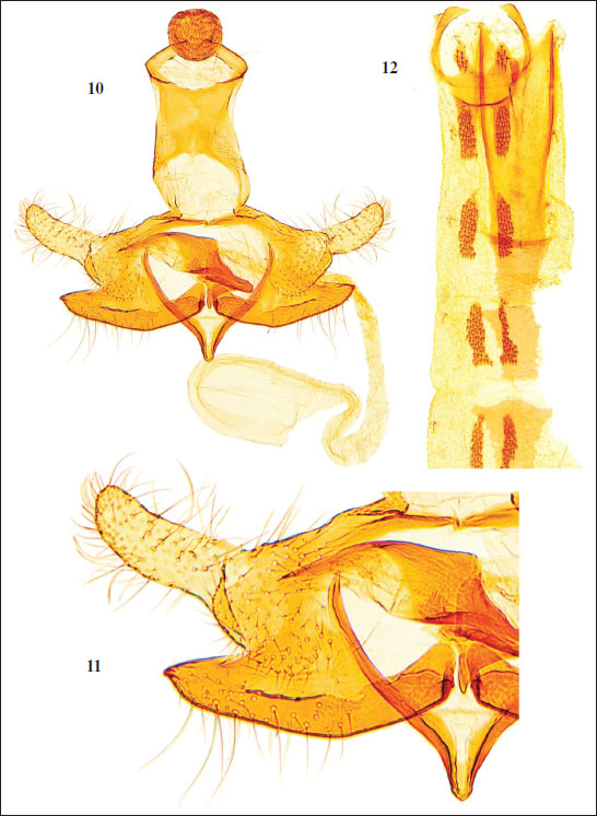 10.C. iordanica Baldizzone, sp. nov. - male genitalia, holotype (GP Bldz 16966). 
										11. Enlarged detail of valva and phallotheca. 
										12. Abdomen.
									