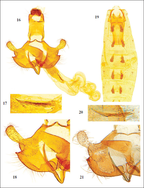 16.C. ratamensis Baldizzone, sp. nov. - male genitalia, holotype (GP Bldz 16961). 
												17. Enlarged detail of cornuti. 
												18. Enlarged detail of valva and phallotheca. 
												19. Abdomen. 
												20.C. celsa, 
												Baldizzone, 1994 - male genitalia, holotype (GP Bldz 5749) enlarged detail of cornuti. 
												21. Enlarged detail of valva and phallotheca.
											
