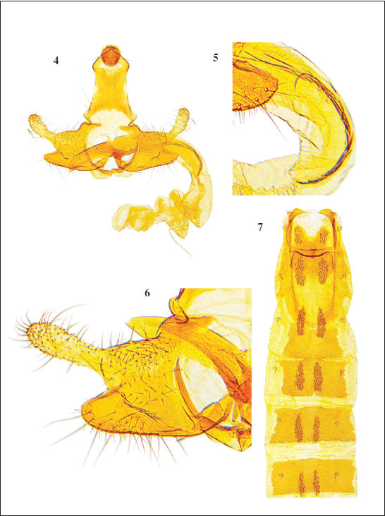 4.C. cantabrica Baldizzone, sp. nov., male genitalia, paratype (GP Bldz 17651). 
									5. Enlarged detail of cornuti, holotype (GP Bldz 17635). 
									6. Enlarged detail of valva and phallotheca, holotype. 7. Abdominal segments 1-6. paratype (GP Bldz 17639).
								
