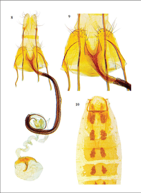 8.C. cantabrica Baldizzone, sp. nov., female genitalia, paratype (GP Bldz 17640). 
										9. Enlarged detail of sterigma and colliculum. 
										10. Abdominal segments 1-5.
									