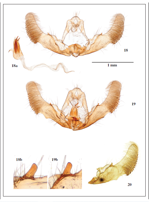 Male genitalia of Notocelia incarnatana (Hübner, [1800]). 18. Sweeden, gen. prep. 23059 JŠ. 19. Czech Republic, gen. prep. 23060 JŠ. 20. France, gen. prep. 37414 JN. (a - aedeagus; b - detail of valvae protuberance).