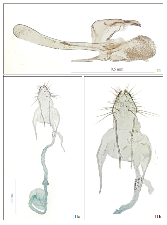 Lourdesiella Bernabé, Huertas & Vives, sp. nov. 11. Paratipo andropigio 11a. Paratipo ginopigio. 11b. Paratipo ginopigio detalle papilas anales.