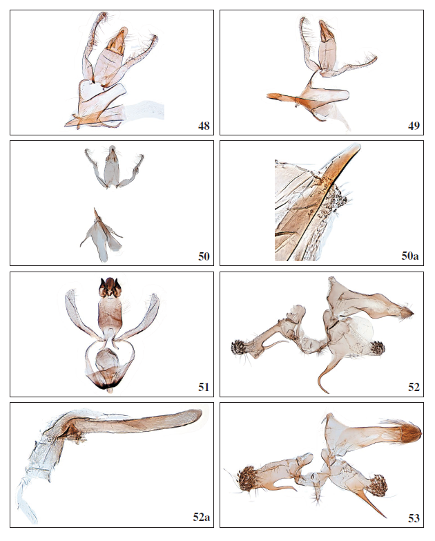 48.Aproaerema ayacatella Falck &
Karsholt, sp. nov., ♂, Gran Canaria, GP3974PF. 49.Aproaerema pseudomercedella
Falck & Karsholt, sp. nov., ♂, El Hierro, GP3964PF. 50.Aproaerema
angustumella Falck & Karsholt, sp. nov., ♂, Tenerife, GP4002PF. 50a.
Aproaerema angustumella Falck & Karsholt, sp. nov., ♂, apex of phallus with
cornuti, La Palma, GP4052PF. 51.Mesophleps ochracella (Turati, 1926), ♂, Lanzarote, GP3997PF. 52.Anarsia
lineatella Zeller, 1839, ♂, Gran Canaria, GP3958PF. 52a. Anarsia
lineatella Zeller, 1839, ♂, phallus, GP3958PF. 53. Anarsia acaciae Walsingham,
1896, ♂, Gran Canaria, GP3956PF.