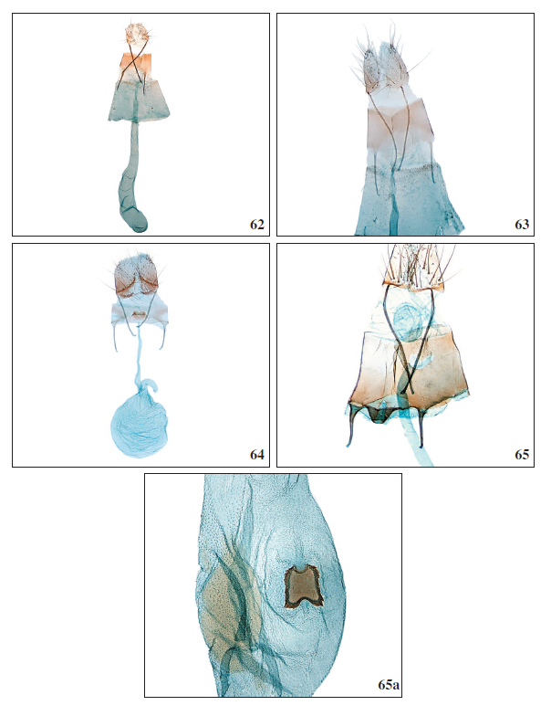 62. Aproaerema pseudomercedella Falck &
Karsholt, sp. nov., ♀, El Hierro, GP3976PF. 63.Aproaerema angustumella Falck
& Karsholt, sp. nov., 0, Tenerife, GP4003PF. 64. Mesophleps ochracella
(Turati, 1926), ♀, Tenerife, GP3996PF. 65.Anarsia acaciae Walsingham, 1896, ♀,
antrum complex, Tenerife, GP3960PF. 65a.Anarsia acaciae Walsingham, 1896, ♀,
corpus bursae, GP3960PF.