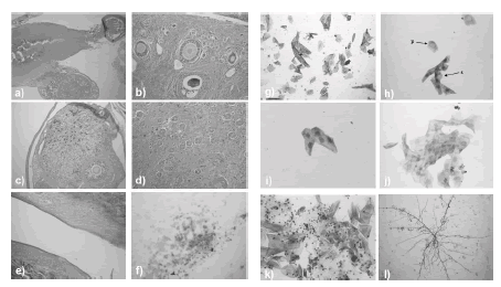 Reproductive tract of a bat in metestrus and vaginal cytology of bats throughout reproduction. a) Stages of folliculogenesis distinguish the left ovary from the b) contralateral ovary c) with a corpus hemorrhagicum. Formed immediately after ovulation, the corpus hemorrhagicum will become a corpus luteum of pregnancy and produce progesterone. d) Straight tubular glands in the endometrium and e) superficial cells lining the vaginal canal confirm estradiol was the dominant hormone prior to ovulation. Changes in exfoliate cytology are shown as follows: f) a mass of parabasal cells, g) superficial cells and intermediate cells, h) parabasal cell (p) and superficial cell (s), i) intermediate cells, j) a mass of intermediate and superficial cells, k) sperm and l) fungus found within the vaginal cytology lavage of bats captured in Santander, Colombia during the breeding season.