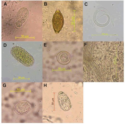 Parasites
from wild black capuchin monkeys in Northeastern Argentina: a) Strongyloides
sp., b) Trichuris sp., c) Filariopsis sp., d) Ascaris sp., e) undetermined Subuluridae, f)
undetermined Physalopteridae, g) undetermined Hymenolepididae, h) undetermined
Trematode.