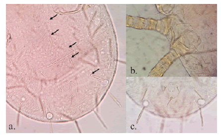 Chiroptonyssus haematophagus, protoninfa. a. Idiosoma, vista ventral. Cinco pares de setas ventrales, adicionales al par caudal, en el área del tegumento desprovista de escudos (flechas negras); b. Peritremo extendiéndose hasta coxa III; c. setas caudales barbadas.