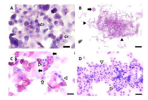 Fases del ciclo estral a partir de frotis vaginales en hembras de Rhipidomys fulviventer. (A) proestro, (B) estro, (C) metaestro, (D) diestro. Células nucleadas (flecha blanca), células cornificadas (flecha negra), leucocitos (triangulo blanco) y  espermatozoides (triangulo negro). Barra de escala 25 µm. 