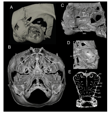 Selected aspects of qualitative anatomy in the cranium of the holotype of Neacomys auriventer sp. nov. (MEPN 12081; Cordillera del C�ndor, Ecuador), scaled to the same length. A, right temporal region in lateral view; B, dorsal view of the basicranial region (roofing bones of braincase removed); C, right squamosal- alisphenoid region in lateral view; D, left auditory capsule in ventral view; and E, 3D representations of turbinal bones. Abbreviations: aalc = anterior opening of alisphenoid canal, ab = auditory bulla (ectotympanic), al = alisphenoid, bet = bony eustachian tube, bmt = trough for masticatory-buccinator nerve, bo = basioccipital, bs = basisphenoid, cc = carotid canal, etI = ethmoturbinal I, etII = ethmoturbinal II, etIII = ethmoturbinal III, ft1 = frontoturbinal 1, ft2 = frontoturbinal 2, fo = foramen ovale, it = interturbinal, ls = lamina semicircularis, pet = petrosal, pgf = postglenoid foramen, ps = presphenoid, pt = petrosal, sag = squamosal alisphenoid groove, stf = stapedial foramen, sfr = sphenofrontal foramen, sq = squamosal.