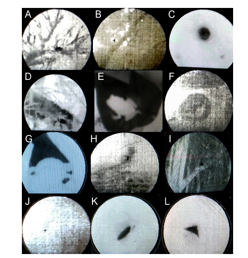 Examples of thermal tracker use in black mode in the field. A) howler monkey individual sleeping on a tree branch; B) howler monkey individual sleeping on a tree branch approximately 100 m away; C) faeces on the ground; D) heat causing colour aberrations; E) frog on a hand; F) snake on the ground; G) fresh water tortoise on a hand; H) tinamou bird on the ground; I) squirrel on a branch; J) humming bird on a branch; K) half a pen under plant litter; and L) a battery almost fully covered by plant litter.