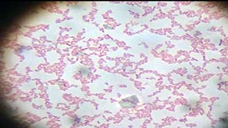 Colonias de B. pseudomallei en agar EMB