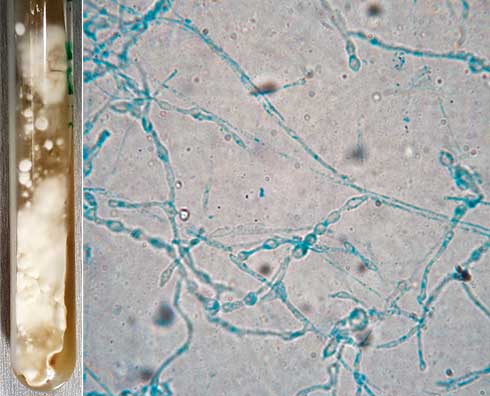 Cultivo de sedimento obtenido por lisiscentrifugación Colonias de crecimiento irregular obtenidas después de 5 semanas de incubación con apariencia algodonosa y granular inicialmente de color blanco que se transforman en marrón claro con el paso de los días Microscópicamente se observan filamentos hialinos septados y algunas estructuras vesiculosas en cadena sin conidios