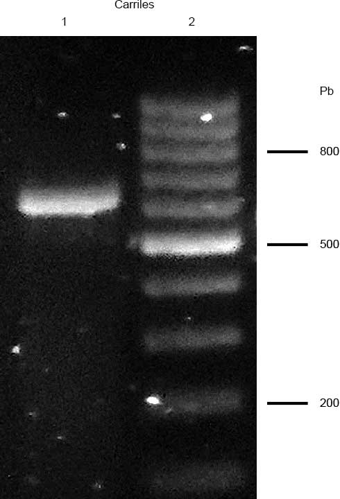 Producto de la reacción en cadena de la polimerasa Corrido en un gel de agarosa a 15% teñido con bromuro de etidio del aislado fúngico obtenido de la paciente con endocarditis infecciosa Carril 1 fragmento de 620 pares de bases pb Carril 2 marcador de peso molecular de 100 pb