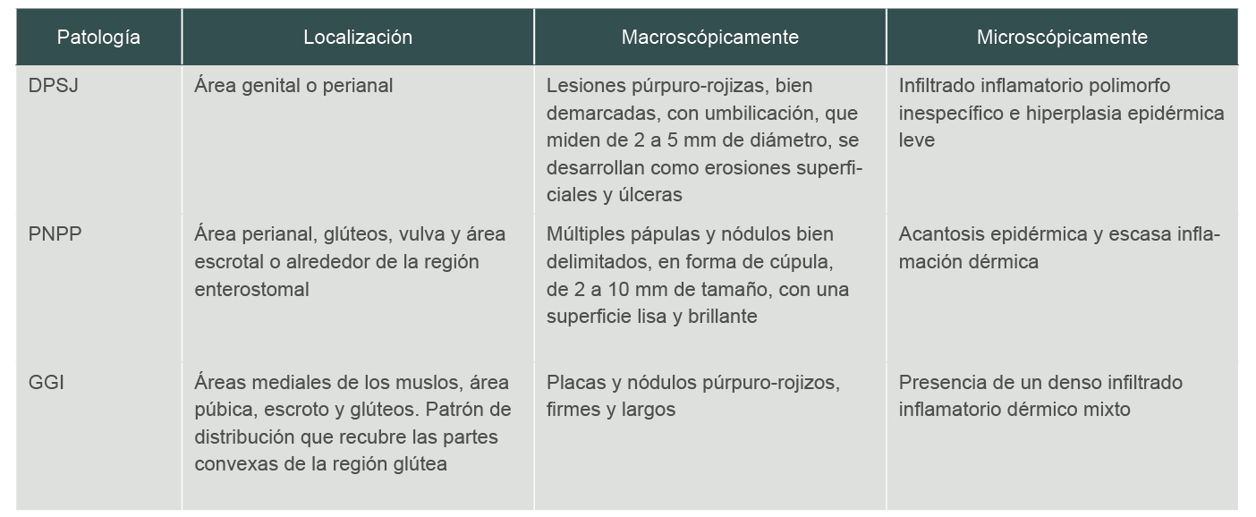 Principales caractersticas diferenciales entre DPJ, GGI y PNPP