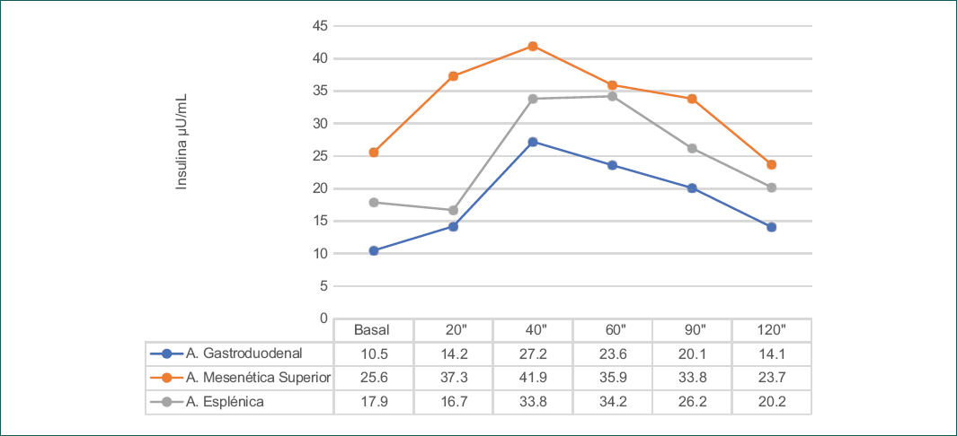 Resultados de la prueba de estimulacin intraarterial selectiva de calcio con muestreo venoso heptico, que muestran un hiperinsulinismo difuso.