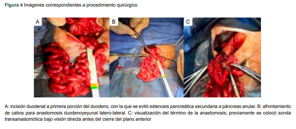 Im�genes correspondientes a procedimiento quir�rgico
