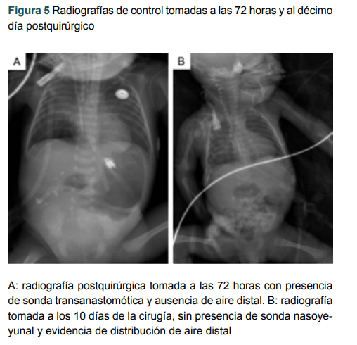 Radiograf�as de control tomadas a las 72 horas y al d�cimo d�a postquir�rgico