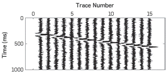 Signal contaminated (zoom 15 traces) with withe Gaussian noise with SNR=5 dB and removed 4 traces.