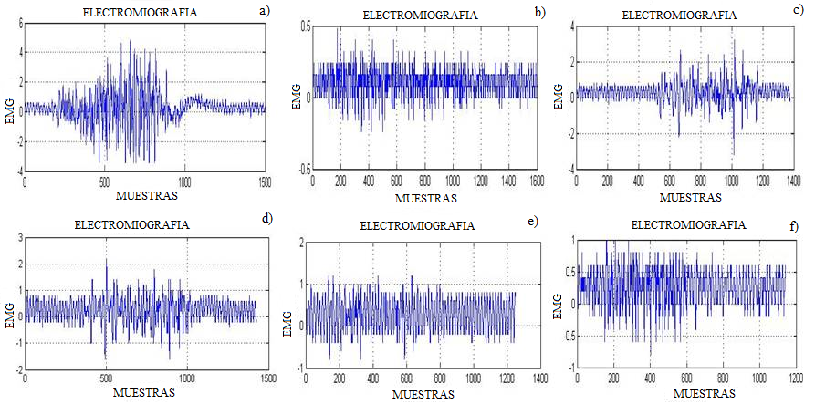 a) Señal mioeléctrica producida por el puño completo, adquirida por arduino y graficada en Matlab b) Señal mioeléctrica producida por el dedo índice, adquirida por arduino y graficada en Matlab c) Señal mioeléctrica producida por el dedo medio, adquirida por arduino y graficada en Matlab d) Señal mioeléctrica producida por el dedo anular, adquirida por arduino y graficada en Matlab e) Señal mioeléctrica producida por el dedo menique, adquirida por arduino y graficada en Matlab f) Señal mioeléctrica producida por el dedo pulgar adquirida por arduino y graficada en Matlab.