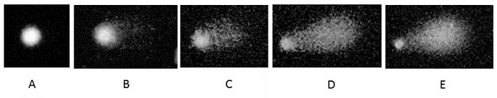 Images of the different comets found according to the dose. A) 0; B)
							15; C) 30; D) 45; E) 60.