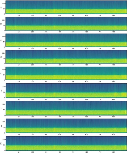 Spectrogram of the filtered EEG Signals obtained in P7, O1, O2,
								FC5, P7, O1, O2, P8, T8, FC6, F4, F8. And AF4 channels.