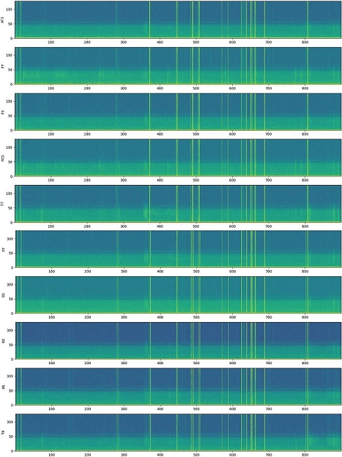Spectrogram of the raw EEG signals obtained in AF3, F7, F3, FC5,
								P7, O1, O2, P8, and T8 channels