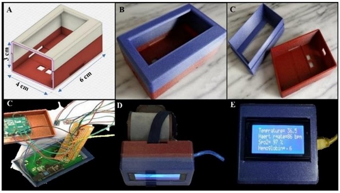 Microsoft 3D builder prototype (a), the upper and lower view of the designed prototype (b and c), the PCB with components (d), wristband prototype tied up with band (e), wristband prototype with display results (f).