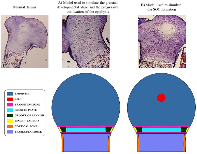 Anatomical zones are considered in the distinct geometrical
								models. Histological images elucidate the scenarios simulated in
								this computational model. A) Anatomical zones considered for the
								first and second developmental scenarios. B) Anatomical zones
								considered for the third developmental scenario. Scale bars = 100
								�m.