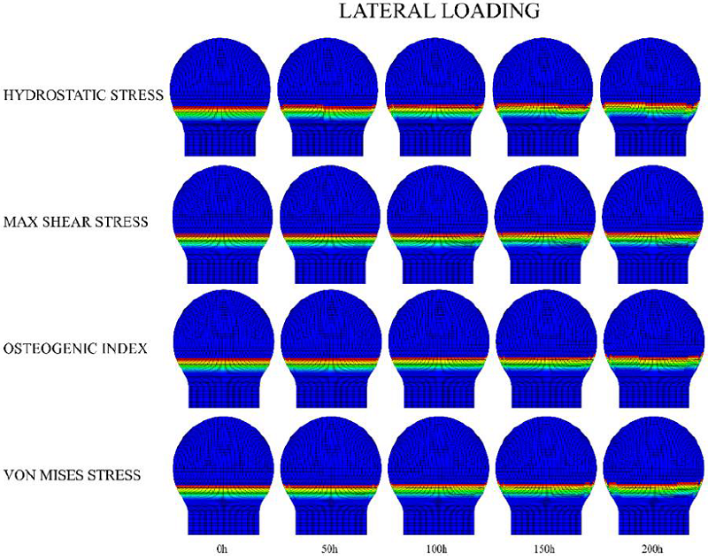 Lateral loading scheme for growth plate morphology changes in a
								completely cartilaginous epiphysis. The legend on the left
								corresponds to the different driving mechanical stimuli for the
								advance of the column.