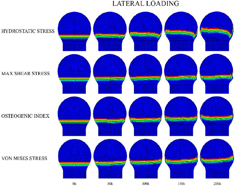 Axial loading scheme for growth plate morphology changes in a
								developing SOC inside the cartilaginous epiphysis. The legend on the
								left corresponds to the driving mechanical stimulus for the advance
								of the column.