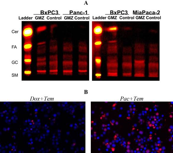 Validation assays for the hybrid mathematical modeling approach of the SL sensor as predictor of chemosensitivity allows the formulation of experimentally-testable hypothesis. (A) Pancreatic cancer cell line using TLC, in which the prediction of changes in SL composition was validated. (B) Predictions of cell viability on a leukemia cell line after double chemotherapeutic treatments were validated experimentally.