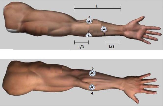 Electrode placement for the acquisition of EMG signals