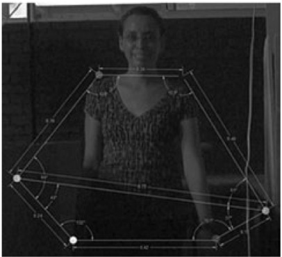 Sujeto
de estudio con los marcadores colocados, as&iacute; como las distancias y &aacute;ngulos
entre ellos.