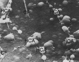 La imagen muestra la formación de hidroxicarbonato de apatita sobre la superficie del material y en íntimo relación con las fibras colágenas