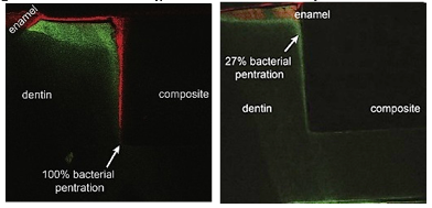 Las imágenes muestran (por fluorescencia) la diferencia en penetración bacteriana en la interfaz dentina-resina y dentina-resina/VB (Khvostenko 2015)
