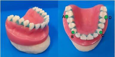 Imagen ilustrativa del modelo maestro de acrílico y los puntos seleccionados para realizar las mediciones tanto del modelo maestro como de los modelos de yeso tipo III.