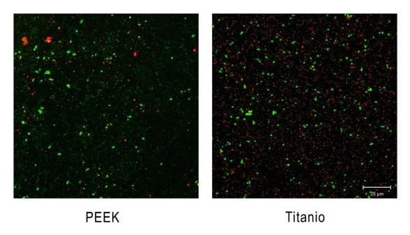 Imagen de microscopía confocal (CLSM) de la superficie de los pilares colonizados por la biopelícula. Si bien se aprecia un mayor volumen de bacterias totales en los pilares de titanio, la proporción de bacterias vivas (en verde) vs. Las muertas (en rojo) es similar en ambos materiales.