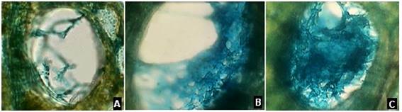 Categoría de daño en función del área de la placa de perforación de vaso obstruida A Daño tipo 1 (<25 %) B Daño tipo 2 (25-50 %) C Daño tipo 3 (>50 %)