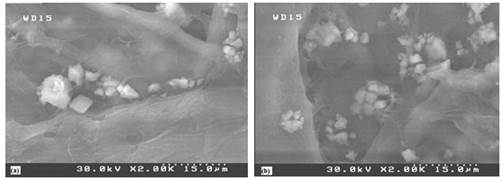 SEM images of paper-sheets filled with PCC: (a) unmodified precipitated calcium carbonate; (b) modified precipitated calcium carbonate under conditions of 4% CMC, 0.8% PAC and pH of 7,5 (magnification 2000x).