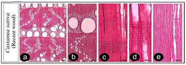 Microscopic photographs of the wood anatomy of Castanea sativa Mill. was obtained from recent wood specimen. (a-b: transverse section, c-d: radial section, e: tangential section., - Scale bar for a = 250 µm, for b, c, e = 100 µm, for d = 50 µm)