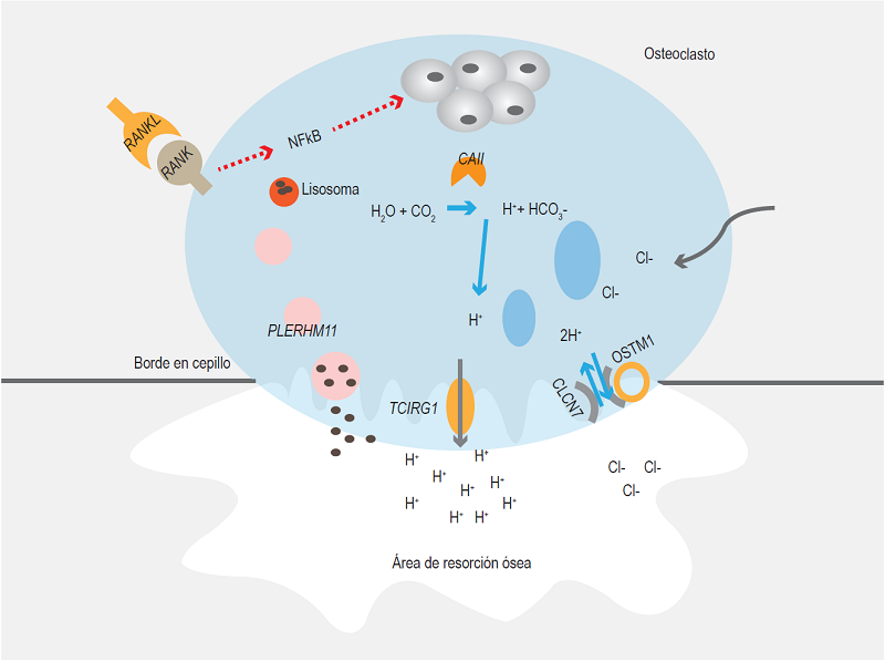 Mostramos las diferentes moléculas codificadas por los genes responsables de la osteopetrosis, señaladas con diferentes letras. Las siglas y función están desglosadas en el cuadro I. Ubicamos de forma general su involucro en los diferentes procesos de la función del osteoclasto. Para que el osteoclasto se diferencie y active el ligando de RANK se une a RANKL, lo cual induce señales se supervivencia celular mediante el factor de transcripción NFκB. Una vez activada la célula, comienzan cambios moleculares y estructurales, se inicia la reorganización del citoesqueleto para la formación del borde en cepillo, se hará contacto con la superficie ósea, creando el área de resorción, con lo que comienza el ensamblaje de dominios V1 y V0 para la formación del complejo enzimático H+ ATPasa-V. Posteriormente se moviliza hacia el borde en cepillo, de la misma forma como sucede con las vesículas lisosomales. Mientras tanto, a nivel citoplasmático se inicia la producción de hidrogeniones, que serán transportados a través de la membrana, junto con iones cloruro, para la formación de ácido clorhídrico en el área de resorción, disminuyendo el pH, que junto con las proteasas lisosomales secretadas al medio llevarán a cabo la remodelación ósea.