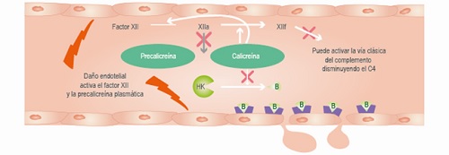 Vía del quininógeno, precalicreína, calicreína y bradicinina. Se observan los efectos del C1-INH en la inhibición del factor XII, con lo que se evita el paso de la precalicreína a calicreín y el efecto inhibidor de la calicreína, lo que impide la conversión del quininógeno a bradicinina. XII = factor de Hageman, XIIa = factor XII activado, HK =quininógeno de alto peso molecular, XIIf = fragmento del factor de Hageman, x = normalmente inhibido por C1-INH, B = bradicinina. Modificado de Macaluso JP. Angioedema hereditario. Buenos Aires: 2019. 