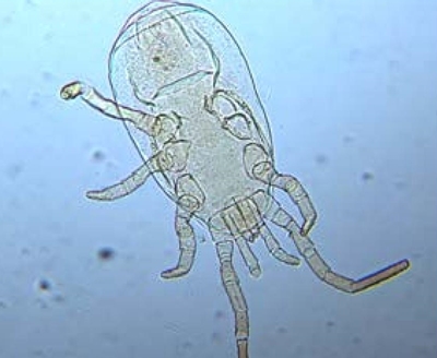 Blattisocius keegani hembra. 